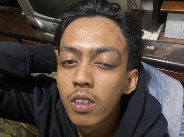 Matikan CCTV Saat Aniaya, Sekap 2 Jam Karyawan: Sarang Kopi Kafe Muyorejo Sukun Diduga Miliki Catatan Hitam